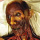 Illustration for article titled Wax anatomical figures are the stuff of nightmares